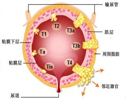 膀胱位於身體什麼部位,有什麼功能?